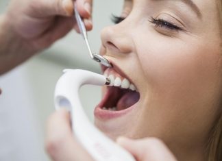 Dental Implant Bone Grafting