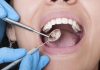 Looking for Low Cost Dental Care? Here’s What You Need to Do