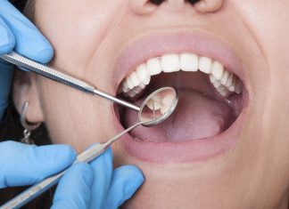Looking for Low Cost Dental Care? Here’s What You Need to Do