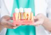 How Much Does a Tooth Implant Cost? Read This to Find Out
